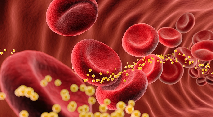 blood cells with cholesterol